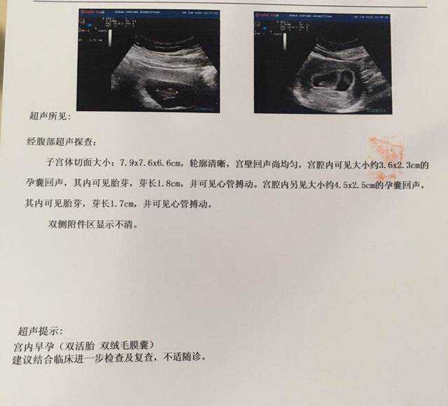 上海58岁“失独”妈妈，失独老年家庭能做供卵试管吗？