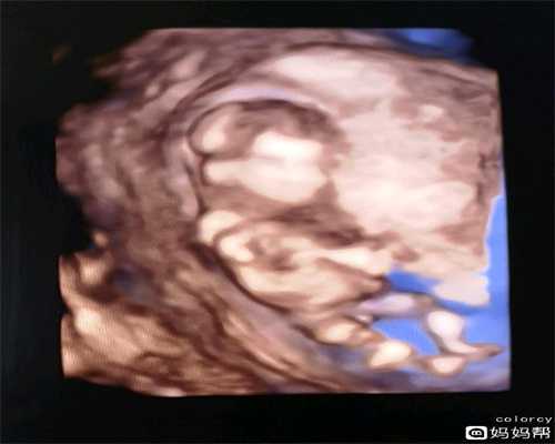 代孕哪家最好-染色体有问题能生孩子吗-重庆代孕身体条件要求